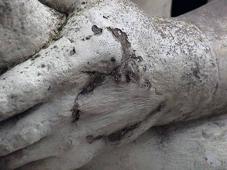 Befund, Detail Hand